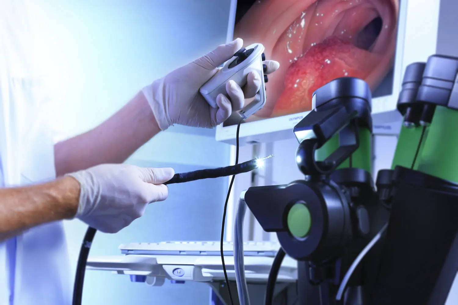 Cost of endoscopy in Bangalore 2025 — transparent pricing at Dhaara Speciality Hospital