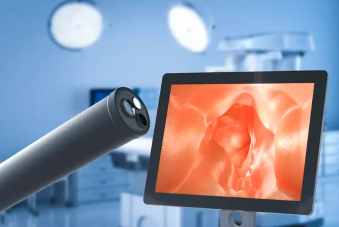 Colonoscopy examination of the colon