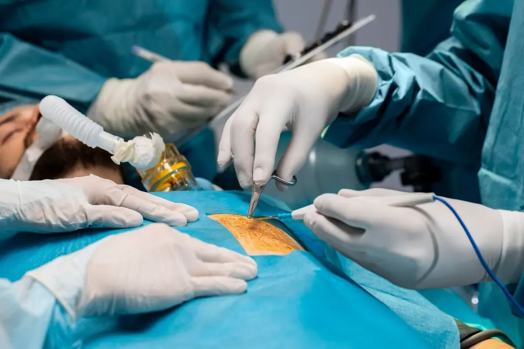 Surgical team performing a laparoscopic procedure