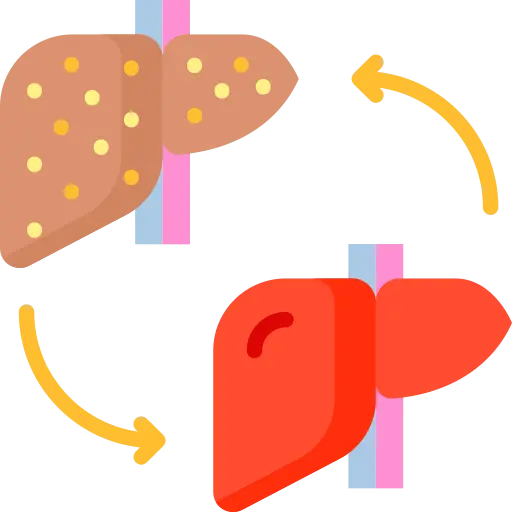 transplant